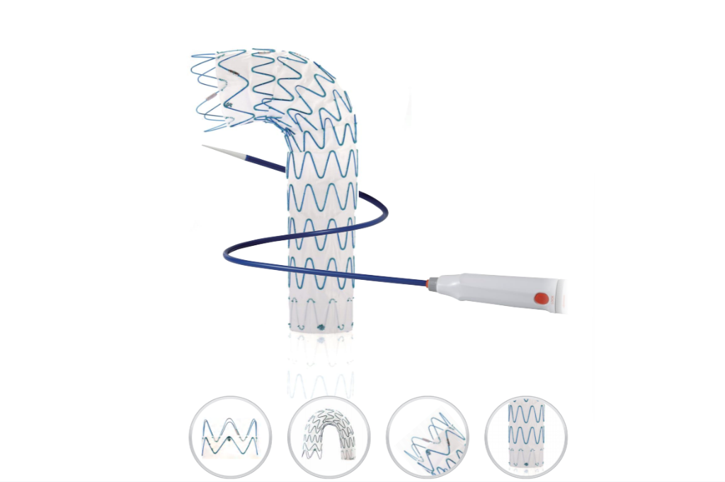 Thoracic Aortic Stent Graft System: Substantial Advances in Endovascular Aortic Repair
